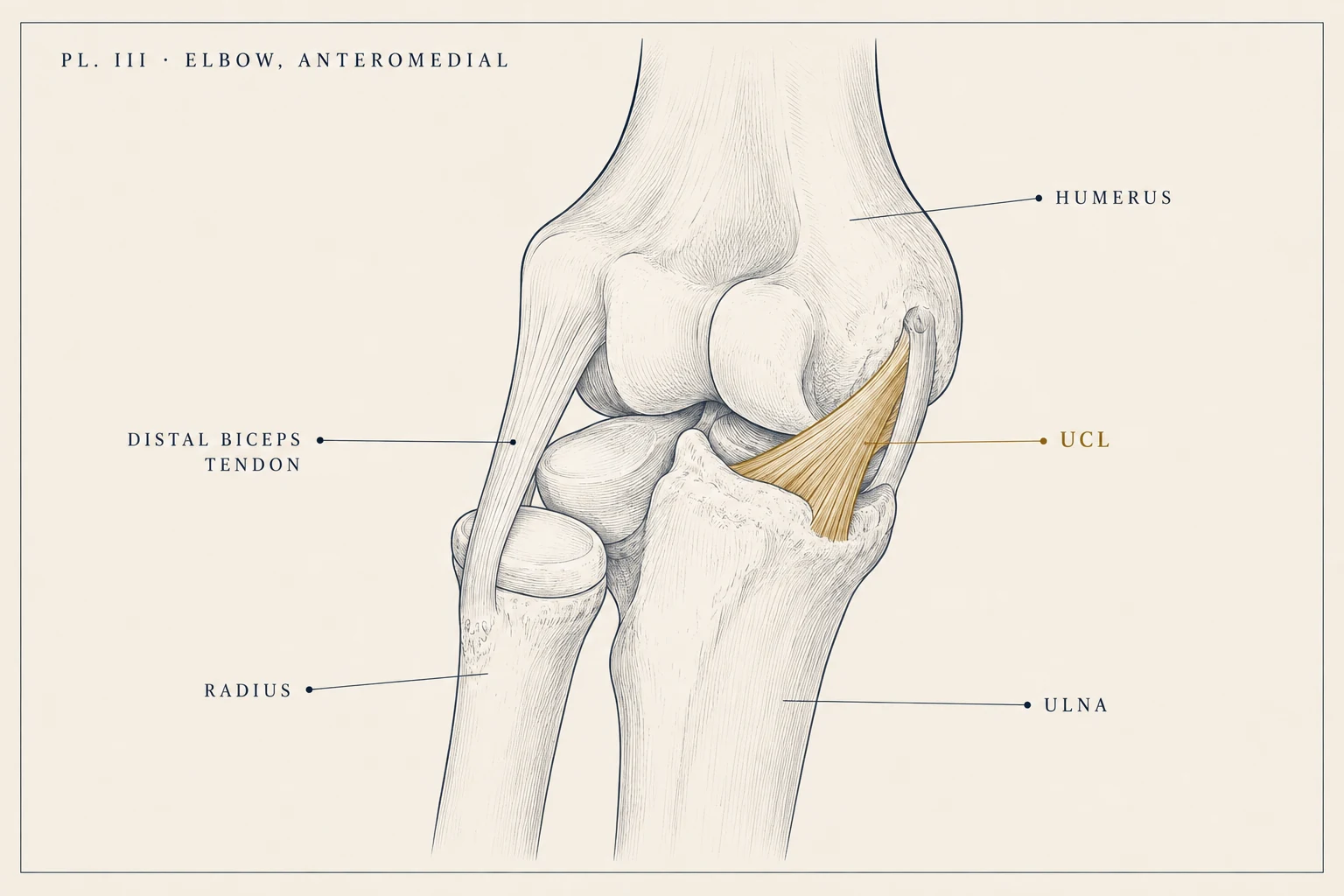 Anatomical plate: the elbow in anteromedial view, with the ulnar collateral ligament highlighted