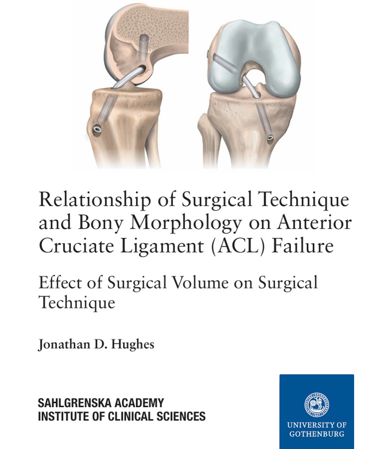 Cover of Dr. Hughes's PhD dissertation on ACL failure, University of Gothenburg